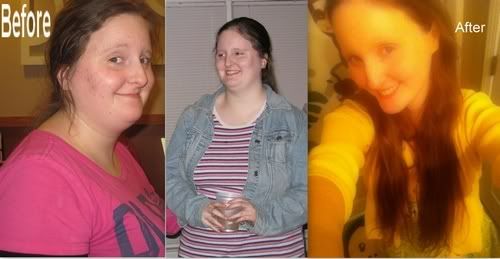 67poundslostbeforeafter-1.jpg